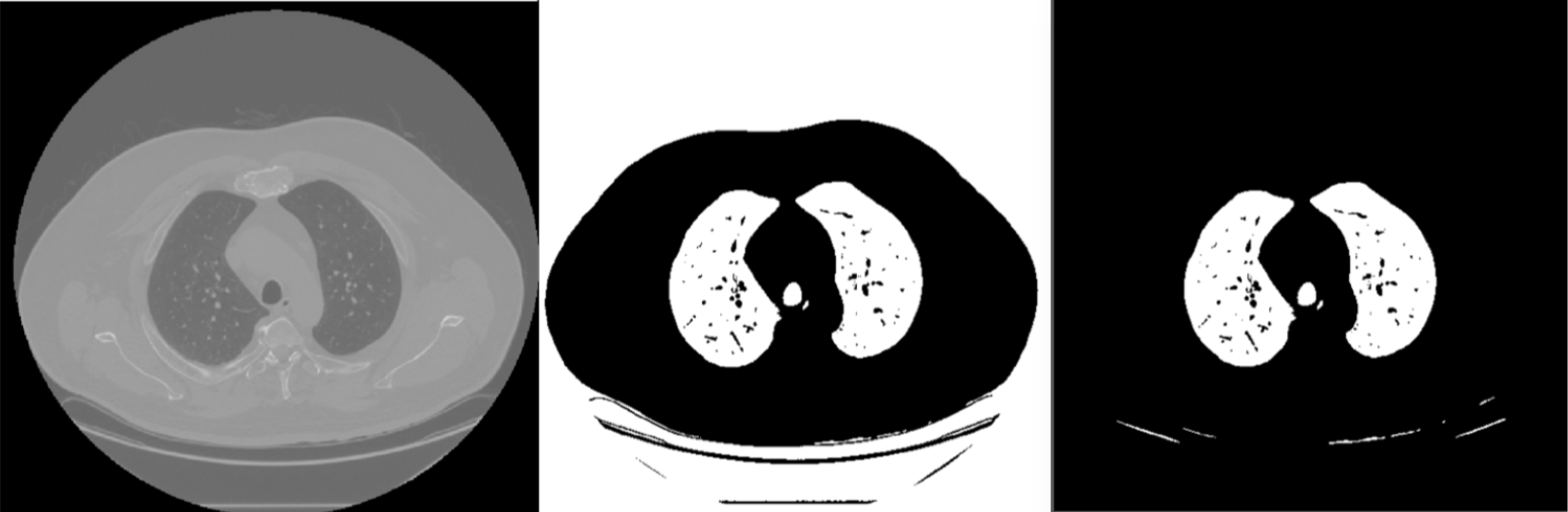 Figure 3: Segmented CT Slice