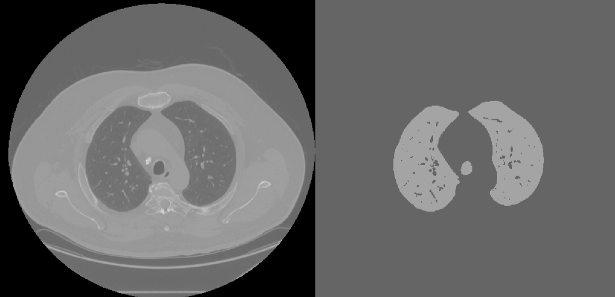 Figure 4: Volume Filtered CT Slice